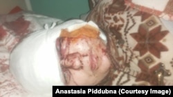 Мать Анастасии Поддубной после авиаудара 