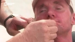 История Виталия Шумея: украинского военного, который потерял часть черепа, лечат в Испании История Виталия Шумея: украинского военного, который потерял часть черепа, лечат в Испании