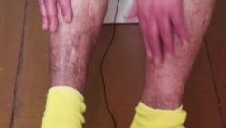 Бывшие заключенные рассказали о невыносимых условиях в женской колонии под Краснотурьинском Бывшие заключенные рассказали о невыносимых условиях в женской колонии под Краснотурьинском