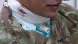 История украинского военного, пережившего пытки в российском плену История украинского военного, пережившего пытки в российском плену