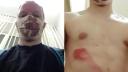 Минчанин – о том, как его избила милиция на пикете в поддержку оппонентов Лукашенко Минчанин – о том, как его избила милиция на пикете в поддержку оппонентов Лукашенко